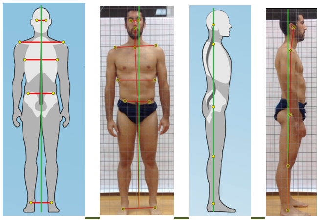 EL ESTATISMO POSTURAL